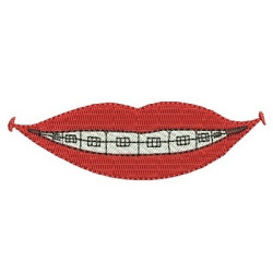 Embroidery Design Orthodontic Appliance